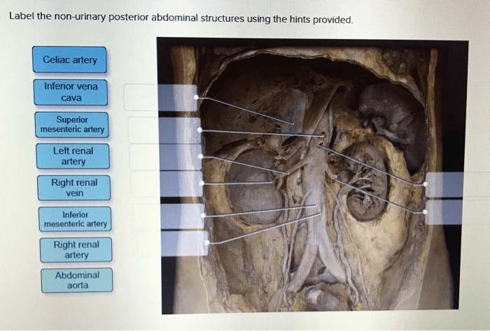 Label the non-urinary posterior abdominal structures using the hints provided