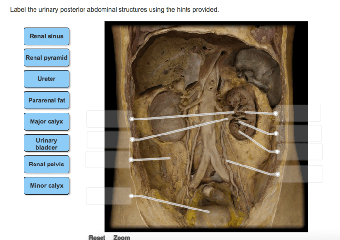 Abdominal cavity model human cavities abdomen anatomy models organs stomach quadrants body kidneys labeled kidney lab system study hard medical